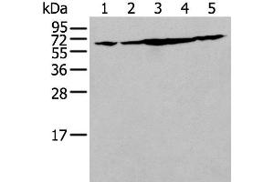 Western blot analysis of NIH/3T3 Hela Jurkat Hepg2 and A549 cell lysates using IRF5 Polyclonal Antibody at dilution of 1:250 (IRF5 anticorps)