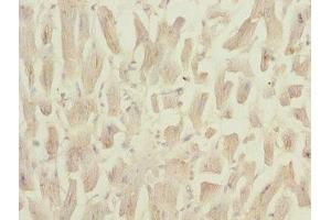 Immunohistochemistry of paraffin-embedded human heart tissue using ABIN7160958 at dilution of 1:100 (NDUFS3 anticorps  (AA 37-264))