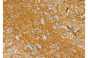 ABIN6266242 and ABIN6277394 at 1/100 staining Rat brain tissue by IHC-P. (Kallikrein 5 anticorps  (Internal Region))