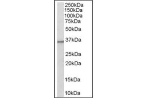 Image no. 1 for anti-Hydroxysteroid (11-Beta) Dehydrogenase 1 (HSD11B1) (C-Term) antibody (ABIN374504) (HSD11B1 anticorps  (C-Term))