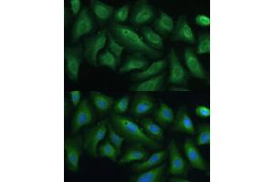 Immunofluorescence analysis of U-2 OS cells using PTPN22 antibody (ABIN3021952, ABIN3021953, ABIN1513449 and ABIN6218285) at dilution of 1:100. (PTPN22 anticorps  (AA 1-90))
