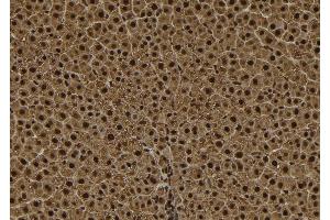ABIN6278564 at 1/100 staining Rat liver tissue by IHC-P. (TPX2 anticorps  (C-Term))