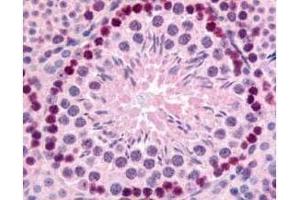 anti-GLI Family Zinc Finger 2 (GLI2) (Internal Region) antibody