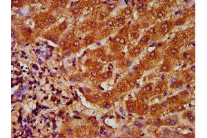 IHC image of ABIN7172799 diluted at 1:200 and staining in paraffin-embedded human liver tissue performed on a Leica BondTM system.
