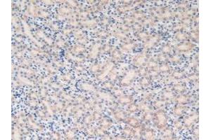Detection of MGST1 in Mouse Kidney Tissue using Polyclonal Antibody to Microsomal Glutathione S Transferase 1 (MGST1)