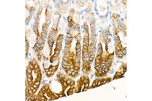 Immunohistochemistry of paraffin-embedded Mouse stomach using Cytokeratin 19 (KRT19) antibody (ABIN7268099) at dilution of 1:100 (40x lens). (Cytokeratin 19 anticorps)