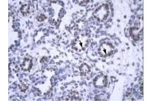 Image no. 1 for anti-YEATS Domain Containing 4 (AA 158-207) antibody (ABIN6735809) (GAS41 anticorps  (AA 158-207))