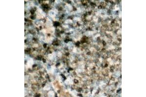 Immunohistochemical analysis of HSL (pS552) staining in human lymph node formalin fixed paraffin embedded tissue section.