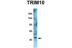Host:  Rabbit  Target Name:  TRIM10  Sample Type:  Human Fetal Kidney  Antibody Dilution:  1. (TRIM10 anticorps  (C-Term))