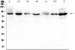 Western blot analysis of SEMA3B using anti-SEMA3B antibody (ABIN6719617).