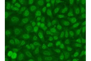 Immunofluorescence analysis of A549 cell using TSEN2 antibody. (TSEN2 anticorps)