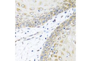 Immunohistochemistry of paraffin-embedded human esophagus using INHBC antibody at dilution of 1:100 (40x lens). (INHBC anticorps)