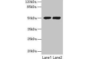 Western blot All lanes: TUBA3E antibody at 3 μg/mL Lane 1: MCF-7 whole cell lysate Lane 2: Hela whole cell lysate Secondary Goat polyclonal to rabbit IgG at 1/10000 dilution Predicted band size: 50 kDa Observed band size: 50 kDa (TUBA3E anticorps  (AA 1-250))