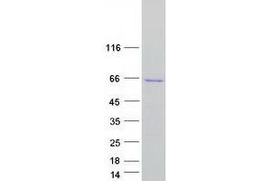Validation with Western Blot