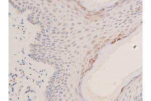 ABIN6267066 at 1/200 staining human skin tissue sections by IHC-P.