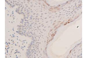 ABIN6267066 at 1/200 staining human skin tissue sections by IHC-P. (p53 anticorps  (acLys319))