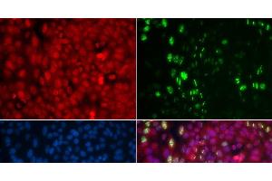 Immunofluorescence analysis of U2OS cells using Phospho-ABL1(Y204) Polyclonal Antibody (ABL1 anticorps  (pTyr204))