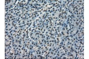 Immunohistochemical staining of paraffin-embedded pancreas tissue using anti-FERMT2mouse monoclonal antibody. (FERMT2 anticorps)