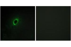 Immunofluorescence analysis of HeLa cells, using BEGIN Antibody. (BEGAIN anticorps  (AA 511-560))