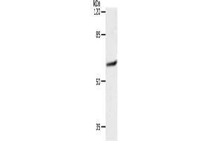 Western Blotting (WB) image for anti-Solute Carrier Family 16 (Monocarboxylic Acid Transporters), Member 4 (SLC16A4) antibody (ABIN2426191) (SLC16A4 anticorps)