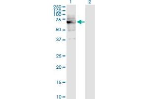 Western Blot analysis of DKC1 expression in transfected 293T cell line by DKC1 monoclonal antibody (M04), clone 3E10. (DKC1 anticorps  (AA 1-514))