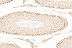 Immunohistochemistry analysis of paraffin-embedded mouse testis using,ZCCHC7 (ABIN7076279) at dilution of 1: 3000 (ZCCHC7 anticorps)
