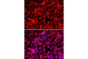 Immunofluorescence analysis of HeLa cell using ANLN antibody.