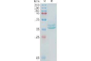 Human A(581-642) Protein, hFc Tag on SDS-PAGE under reducing condition.