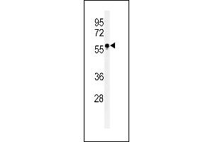 Western blot analysis of FUT6 Antibody (Center) (ABIN651118 and ABIN2840083) in HL-60 cell line lysates (35 μg/lane).