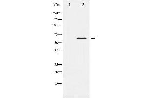 Western blot analysis of Elk1 expression in HeLa whole cell lysates,The lane on the left is treated with the antigen-specific peptide. (ELK1 anticorps  (C-Term))