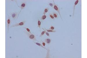 Immunocytochemistry analysis of Hela cells using ABIN7139159 at dilution of 1:100 (HIST1H3A anticorps  (H3K14ac))