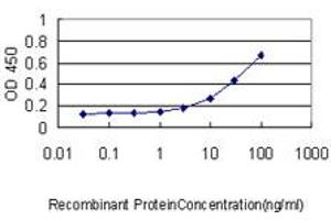 Detection limit for recombinant GST tagged ZAK is approximately 0.
