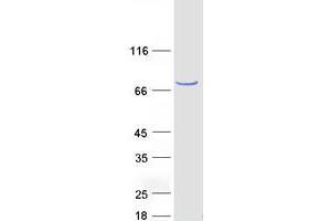 Validation with Western Blot