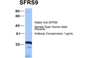 Host: Rabbit Target Name: SFRS9 Sample Type: Human Adult Placenta Antibody Dilution: 1. (SFRS9 anticorps  (Middle Region))