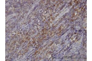Immunoperoxidase of monoclonal antibody to RASGRP4 on formalin-fixed paraffin-embedded human tonsil.