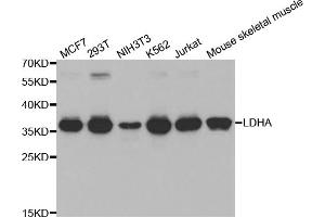 Western blot analysis of extracts of various cell lines, using LDHA antibody (ABIN5970494) at 1/1000 dilution. (Lactate Dehydrogenase A anticorps)