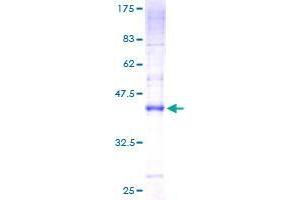 Image no. 1 for CKLF-Like MARVEL Transmembrane Domain Containing 7 (CMTM7) (AA 1-175) protein (GST tag) (ABIN1349799)
