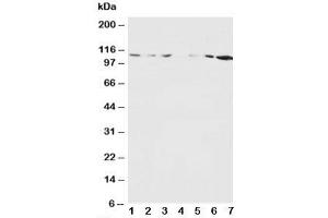 Western blot testing of NMDAR1 antibody and Lane 1:  rat brain;  2: rat brain;  3: rat liver;  4: rat heart;  5: MM453;  6: MM231;  7: HeLa cell lysate