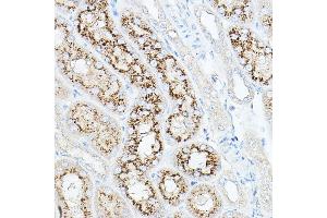 Immunohistochemistry of paraffin-embedded mouse kidney using NEU1 Rabbit pAb (ABIN6129462, ABIN6144538, ABIN6144539 and ABIN6221903) at dilution of 1:100 (40x lens).