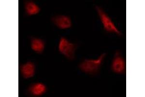 ABIN6267592 staining NIH-3T3 by IF/ICC. (MEK1 anticorps  (pThr292))