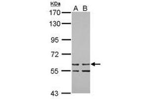 Image no. 1 for anti-Zinc Finger Protein 419 (ZNF419) (AA 1-151) antibody (ABIN1501844) (ZNF419 anticorps  (AA 1-151))