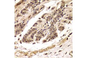Immunohistochemistry of paraffin-embedded Human mammary gland using TDO2 antibody at dilution of 1:100 (x400 lens).