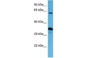Host:  Mouse  Target Name:  SRC  Sample Tissue:  Mouse Spleen  Antibody Dilution:  1ug/ml