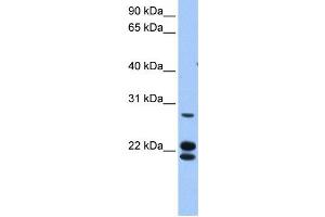 Western Blotting (WB) image for anti-Zinc Finger Protein 724, Pseudogene (ZNF724P) antibody (ABIN2459456) (ZNF724P anticorps)