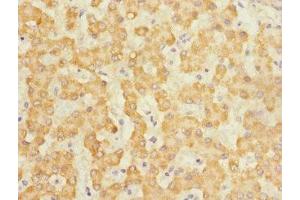 Immunohistochemistry of paraffin-embedded human liver tissue using ABIN7146045 at dilution of 1:100 (C-Type Lectin Domain Family 1, Member B (CLEC1B) (AA 55-229) anticorps)