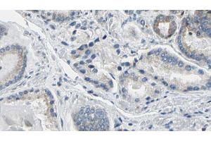 ABIN6274781 at 1/100 staining Human prostate tissue by IHC-P. (RPL36 anticorps  (C-Term))