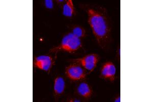 IF analysis of CCNB1 using anti-CCNB1 antibody (ABIN7599335). (Cyclin B1 anticorps  (AA 1-383))
