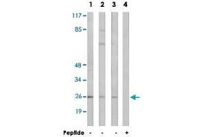 Western blot analysis of extracts from LoVo cells (Lane 1), K-562 cells (Lane 2 and lane 4) and HT-29 cells (Lane 3), using ARF4 polyclonal antibody . (ARF4 anticorps  (AA 71-120))