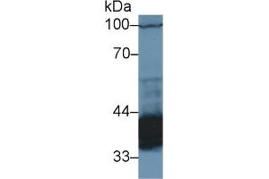 Detection of PDHb in Rat Cerebrum lysate using Polyclonal Antibody to Pyruvate Dehydrogenase Beta (PDHb) (PDHB anticorps  (AA 31-341))