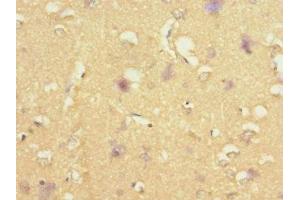 Immunohistochemistry of paraffin-embedded human brain tissue using ABIN7170732 at dilution of 1:100 (STRADA anticorps  (AA 25-210))